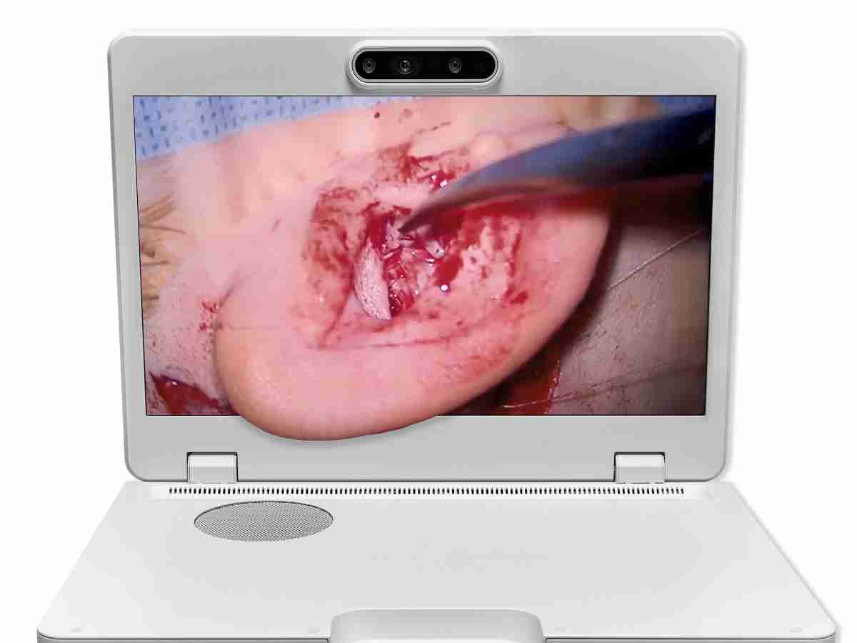 达擎之＂Heads-up 3D显微手术显示系统＂，，整合4K裸眼3D显示及眼球追踪系统，，具备快速追踪人眼移动位置功能，，，减轻医师长时间维持固定姿势的负担，，，让医师能有更宽广清晰的3D立体视野及更舒适的姿势来执行手术。。。